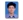 衛生署於2006年之分析指出膽囊癌佔全部癌症死亡之第十二位，佔男性癌症死亡之第十一位，而佔女性癌症死因之第九位﹐每十萬人口死亡率為3.2人，因此其並非罕見的癌症。但早期膽囊癌很難事先診斷出來，通常是在膽囊切除手術後，方由病理切片診斷出。