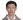40歲男性病患民國95年於台北某醫學中心接受左側頰黏膜口腔癌手術治療，今年7月感覺左後側頰黏膜有持續不癒的潰瘍腫塊，8月份至麻豆新樓醫院口腔顎面外科求診，經醫院口腔顎面外科邱昶達醫師切片後醫師證實為左後側頰黏膜鱗狀上皮細胞癌。